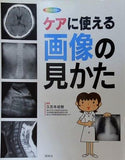 ケアに使える画像の見かた: X線写真・CT画像・エコ-像・MRI