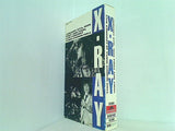 X-RAY JANUARY 27th 1986 FIRST AND FINAL LIVE CONCERT AT YUBIN CHOKIN HALL